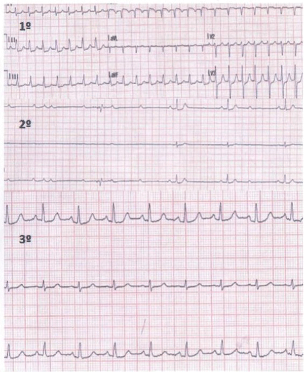 Octava Imagen de Cardiología del Examen MIR 2018