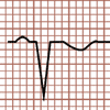 Morphologie du complexe QRS QS, nécrose