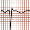 Morphologie du complexe QRS Qr