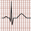 Positive QRS Complex