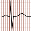 omplexe QRS isodiphasique