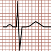 Biphasic QRS Complex