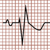 Morphologie du complexe QRS rSr', Bloc de branche droit