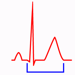 Intervalle QT