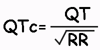 Fórmula del QT corregido