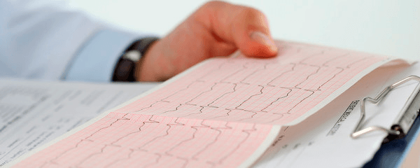 Qué es el Electrocardiograma