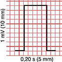 Electrocardiogram Paper Calibration