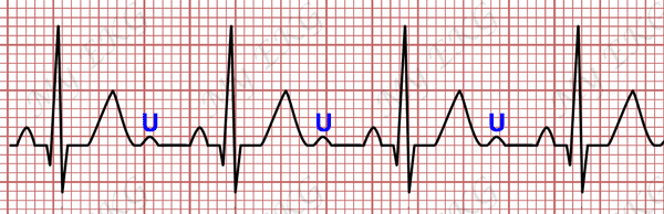 The U Wave